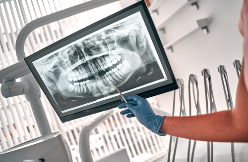 Dental Cleanings