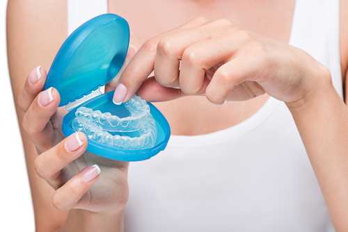 Invisalign timeline