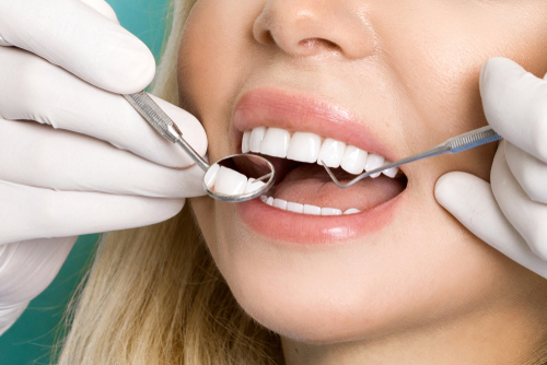 porcelain veneers cost