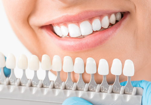 Get a Perfect Smile with Cosmetic Dentistry